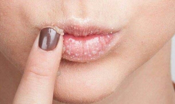Consejos para tener los labios bonitos y cuidados 😚 3
