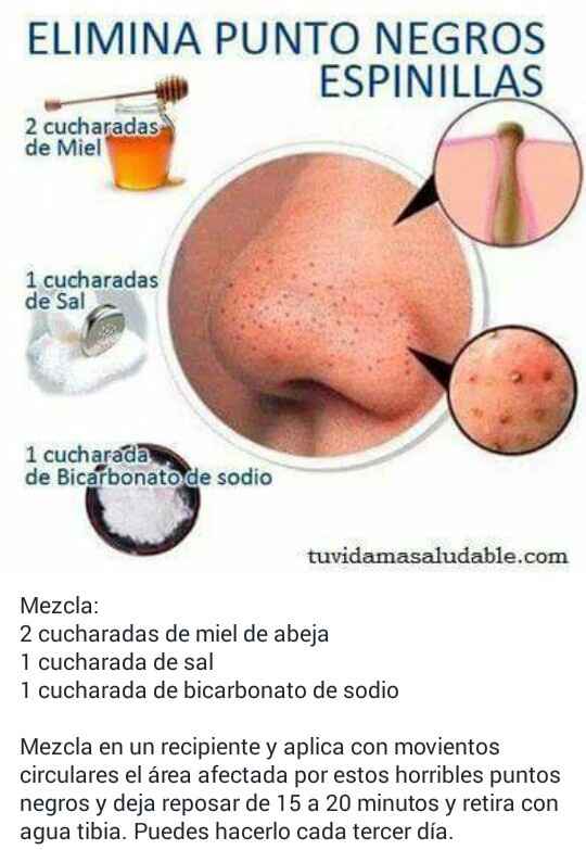  Dato producto para los puntos negros - 1