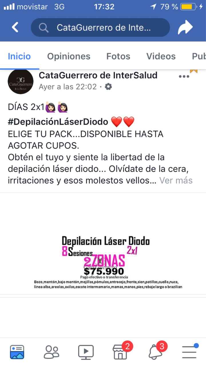 Depilación láser: cuál es la mejor? - 1