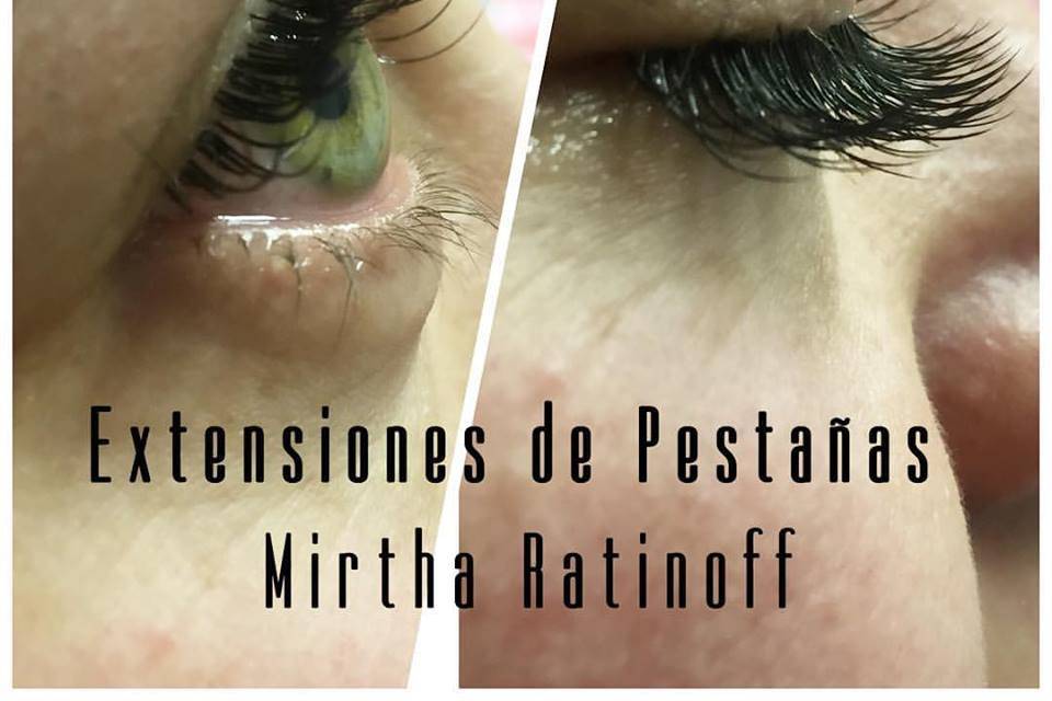 Centro de Estética Mirtha Ratinoff