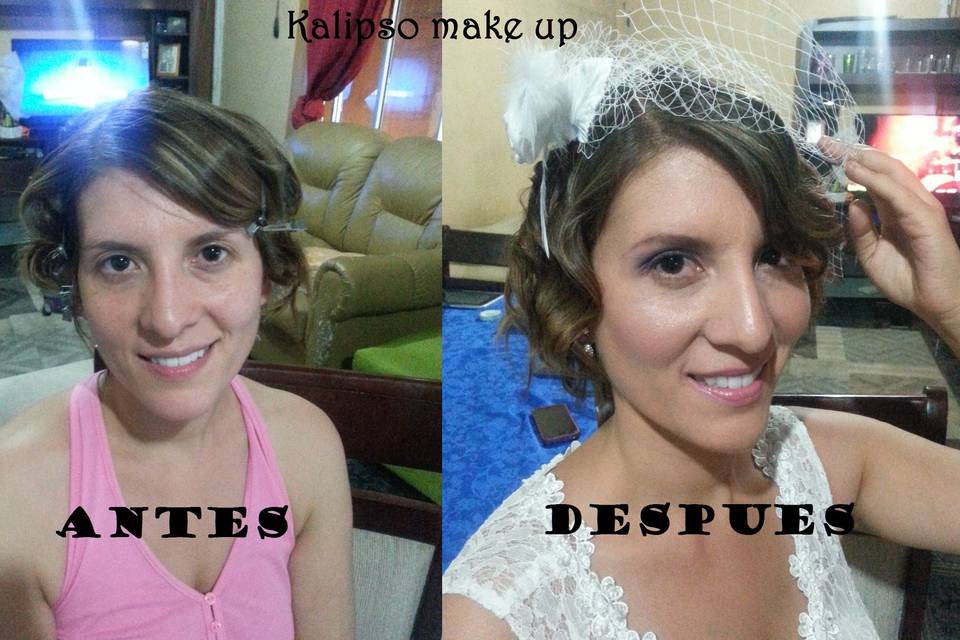 Antes/despues