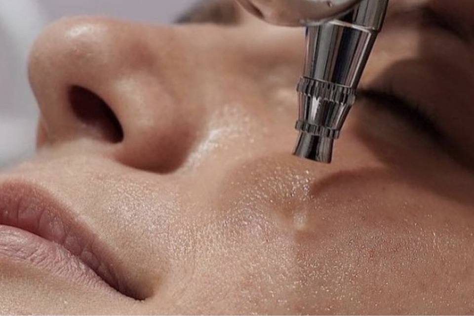 Facial oxigenoterapia